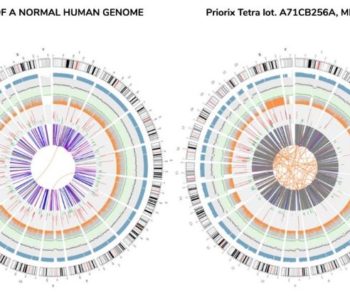 Image of Corvelva priorix-tetra normal and cancerous na